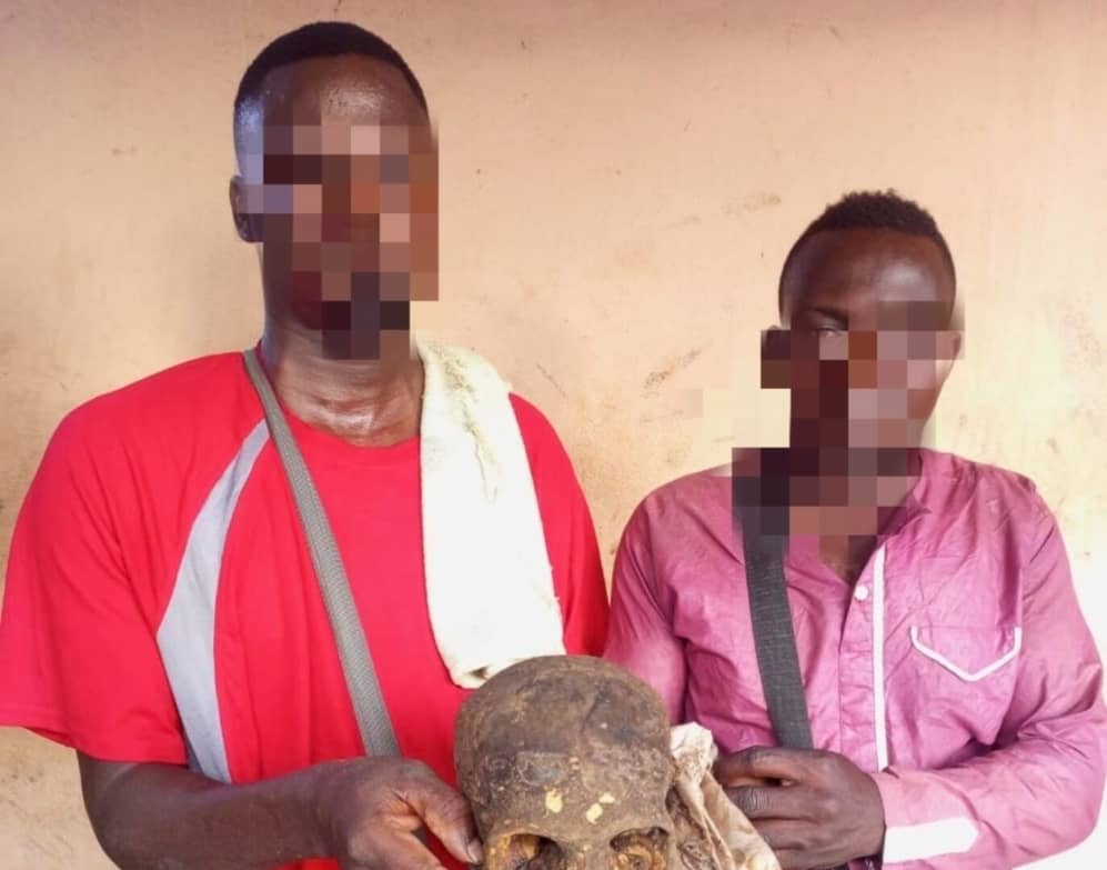 Bénin : 02 individus interpellés avec un crâne humain dissimulé dans un carton
