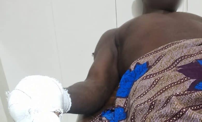 Djidja : une altercation entre agriculteurs et éleveurs vire au drame, un jeune homme perd un doigt après un coup de machette