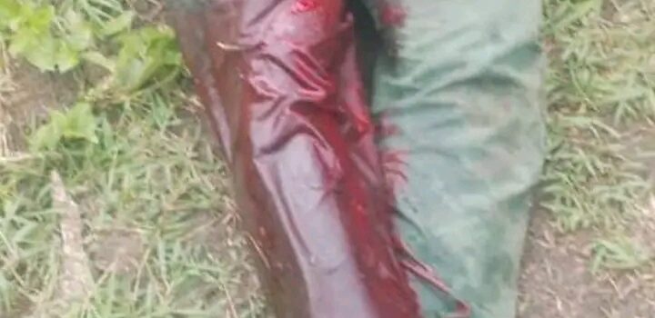 Zogbodomey : des dégâts causés par des bœufs provoquent une altercation, un agriculteur blessé
