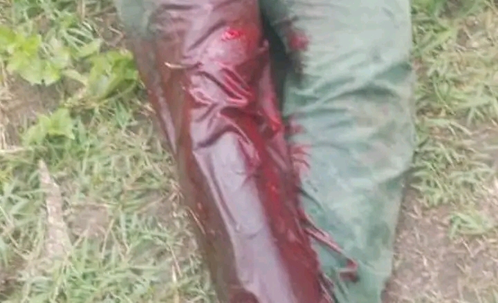 Zogbodomey : des dégâts causés par des bœufs provoquent une altercation, un agriculteur blessé